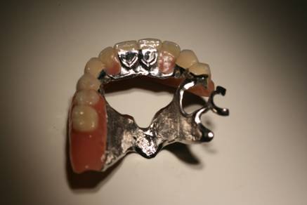 DentaMedika zubní Brno - Zásuvné spoje 5
